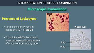 How to perform upper GI endoscopy [upl. by Misty616]