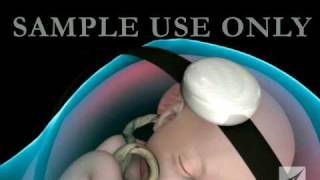 7 WEEKS FETAL DOPPLER BABYS HEARTBEAT [upl. by Ahsahs662]