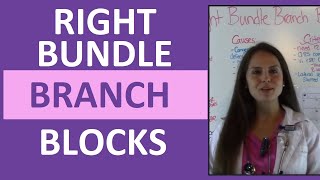 How to Interpret EKG Right Bundle Branch Blocks on ECG for Nurses [upl. by Ermey741]