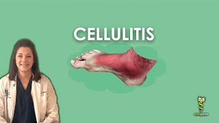 Cellulitis [upl. by Halstead]