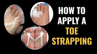 How Do I Do Toe Strapping Dislocated and Fractured Toe [upl. by Nehr]