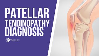 How to Diagnose Patellar Tendinopathy  Jumpers Knee Diagnosis [upl. by Rahal]