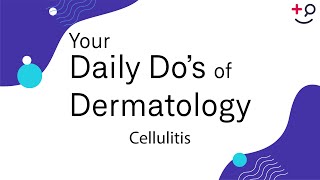 Cellulitis  Daily Dos of Dermatology [upl. by Collette]