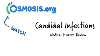 Candidal Infections Osmosis Study Video [upl. by Ahsinel772]