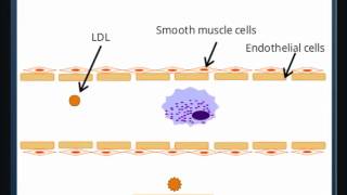 Atherosclerosis [upl. by Cohen]