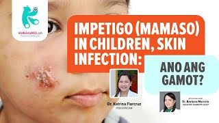 Impetigo Mamaso in Children Skin Infection – Ano ang Gamot [upl. by Namzaj]