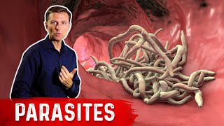 The Best Herbs for Parasites [upl. by Sapienza]