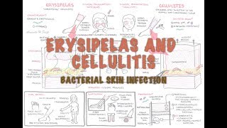 Bacterial Skin Infection  Cellulitis and Erysipelas Clinical Presentation Pathology Treatment [upl. by Aiem]