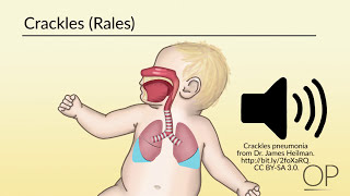 How Babies Breathe in The Womb [upl. by Oiluig]