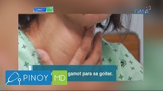 Pinoy MD May gamot ba para lumiit ang goiter [upl. by Horner]