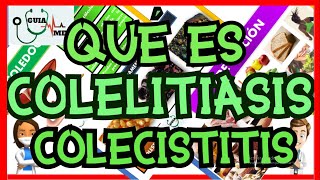 MEJOR EXPLICACIÓN COLELITIASIS COLECISTITIS COLEDOCOLITIASIS COLANGITIS [upl. by Arabela273]