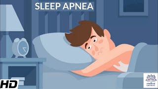 Sleep Apnea CausesSigns and Symptoms DIagnosis and Treatment [upl. by Tsan]