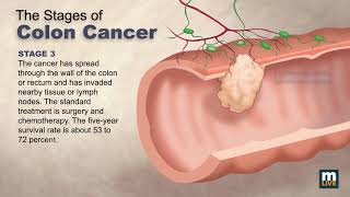 Anatomy  The Three Types of Skin Cancers [upl. by Jarek]