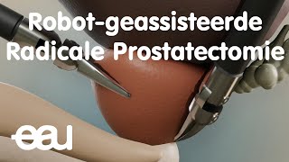 Robotgeassisteerde Radicale Prostatectomie [upl. by Haimaj]