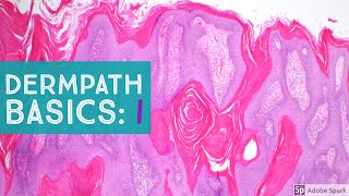 Basic Dermpath Cases  Explained by a Dermatopathologist [upl. by Viki]