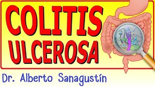 COLITIS ULCEROSA explicada fácil [upl. by Tikna]