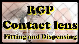 RGP contact lens Fitting and Dispensing  Sri Sankaradeva Nethralaya Guwahati [upl. by Aicul735]