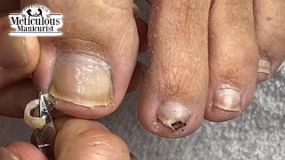 Mr Meticulous Deep Sidewall Cleaning Ingrown Prevention [upl. by Haldan]