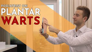 Plantar Warts Explained  Lewis Nurney Singapore Podiatrist [upl. by My612]