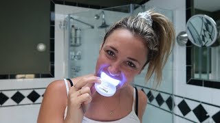 Do athome teeth whitening kits really work  Glam Lab [upl. by Ived]