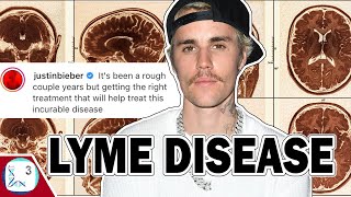 Lyme Disease Is On The Rise And Its Bad [upl. by Canning]