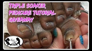 Pedicure Tutorial Excessive Buildup Removal Toenail Cleaning 😎 [upl. by Rma]