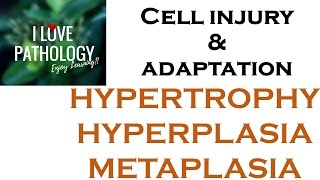 Cell Adaptations pathologyHYPERTROPHY HYPERPLASIA AND METAPLASIA [upl. by Emmie]