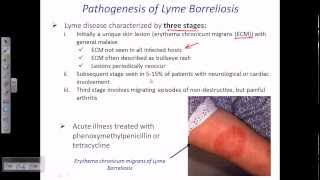 Lyme disease by borrelia [upl. by Ariek]