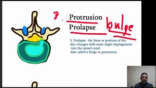 Intervertebral Disk Herniation prolapse  Four Stages of Herniation Made simple [upl. by Airel]