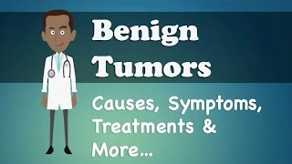 Benign Bone Tumors  ABOS Orthopedic Surgery Board Exam Review [upl. by Cresida]