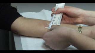 TB Skin Test  Mantoux Method [upl. by Haimes]