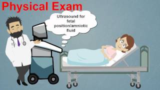 Topic 25 Premature Rupture of Membranes [upl. by Notle]