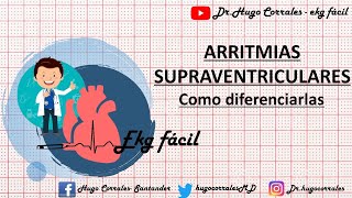 ARRITMIAS SUPRAVENTRICULARES  como diferenciarlas [upl. by Ettedranreb]