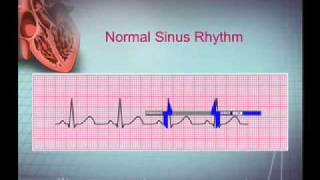 Intro EKG Interpretation Part 1 [upl. by Anis]