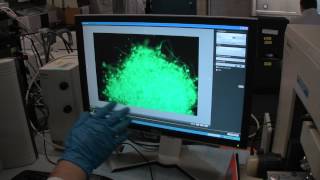 Borrelia Burgdorferi Biofilm  Live Microscopy Video [upl. by Onairpic]