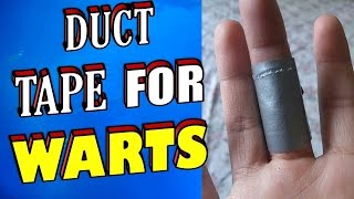 How To Remove Warts amp Verrucas Using Duct Tape [upl. by Nonnah]