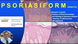 DERMATOPATHOLOGY Psoriasiform Dermatitis [upl. by Htelimay]