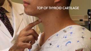 The Thyroid Exam Stanford Medicine 25 [upl. by Okeim]