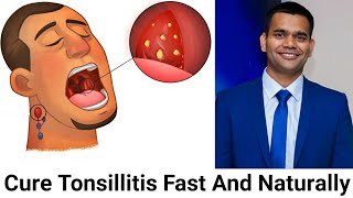 How To Cure Tonsillitis Fast And Naturally Powerful Home Remedies For Tonsil Stones That Works Fast [upl. by Ennailuj]