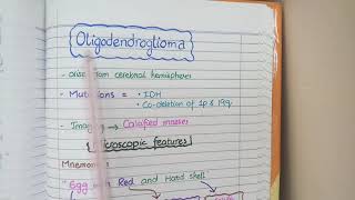 CNS Tumors  Robbins Pathology [upl. by Jaclyn]