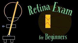 Retina exam on slit lamp  COMPLETE GUIDE [upl. by Bryana]