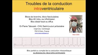 Thorax 5  Vascularisation du cœur Coronary arteries cardiac veins [upl. by Zilla]