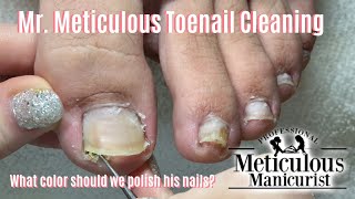 Shortn Sweet  Mr Meticulous Satisfying Impacted Toenail Cleaning [upl. by Assitruc]