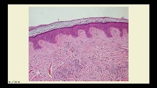 Basics of Dermatology Part One  CRASH Medical Review Series [upl. by Leese]