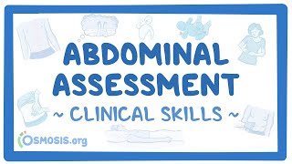 Abdominal Assessment Clinical Skills [upl. by Rhiana231]