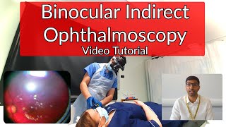 Binocular Indirect Ophthalmoscopy Tutorial [upl. by Tower34]