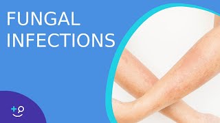 Fungal Infections  Causes Prevention and Cure [upl. by Selokcin]