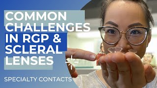 Specialty Contact Lenses Common Challenges [upl. by Crow]